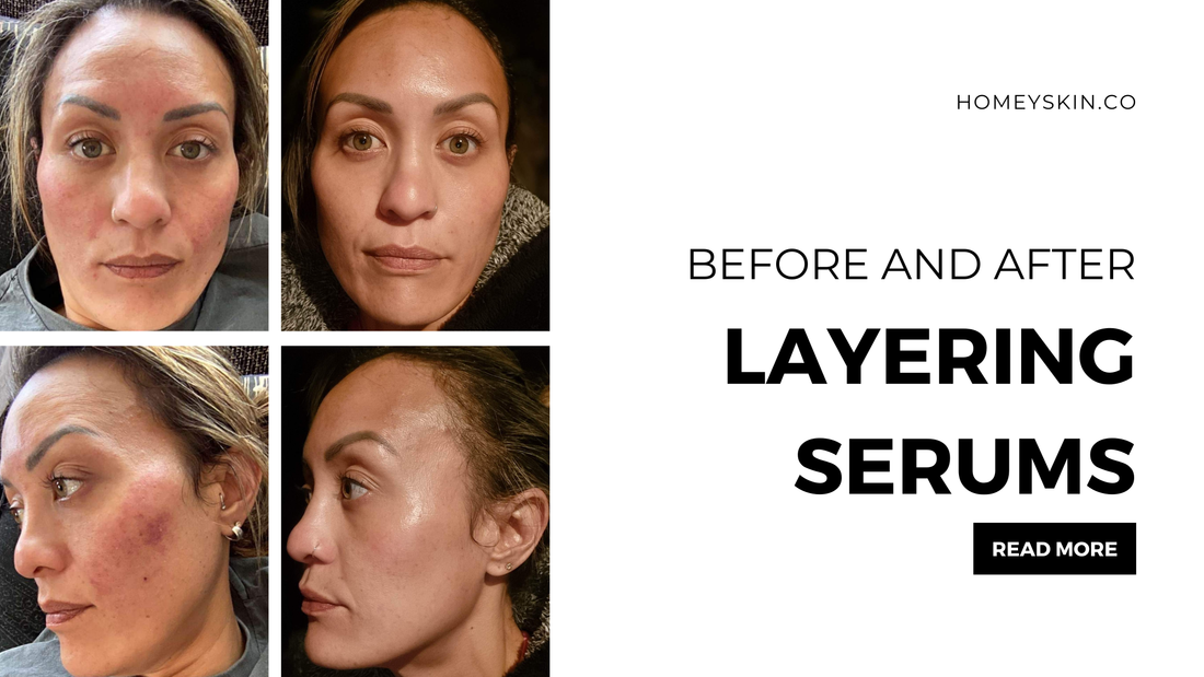 Layering Serums Technique